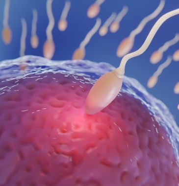 Inseminação Intrauterina